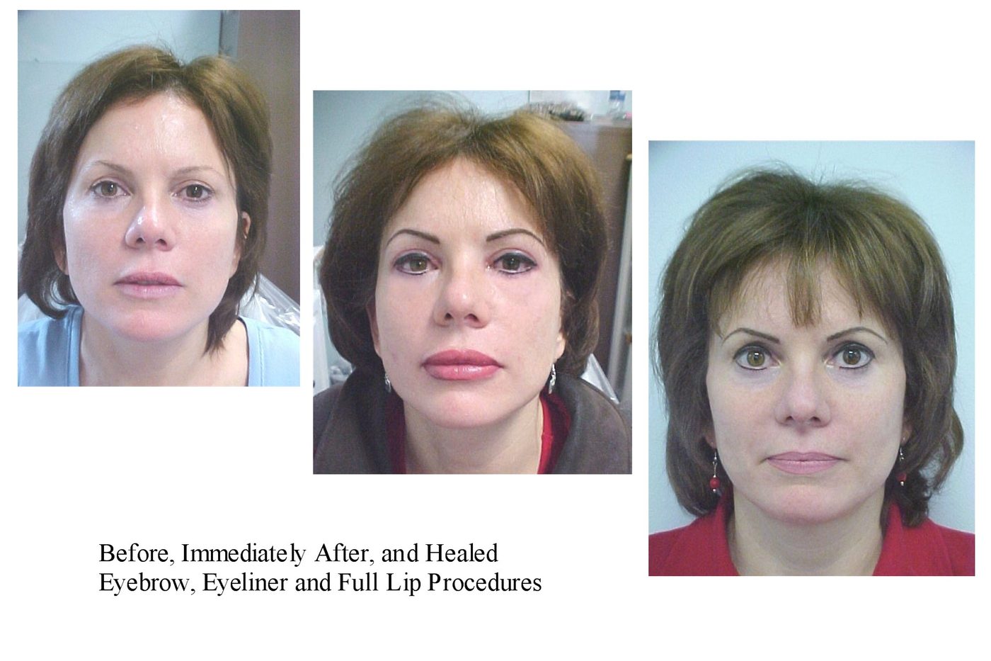 Lip Blushing vs the Old 'Lipstick Tattoo'