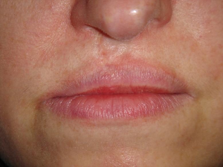 Is Lip Blushing Permanent?